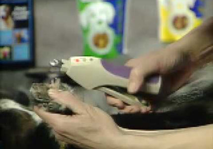 Miracle Care QuickFinder Nail Trimmer – Sensor-Activated Safety, Precision Cutting, Purple