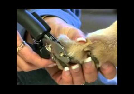 Miracle Care QuickFinder Deluxe Nail Clippers – Sensor Technology, Professional Precision and Safety