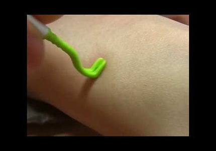 Tick Twister Trio Tick Removal Kit – Complete Set with Three Durable Tick Extractors