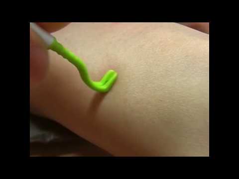 Tick Twister Trio Tick Removal Kit – Complete Set with Three Durable Tick Extractors