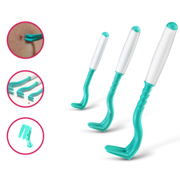 Tick Twister Trio Tick Removal Kit – Complete Set with Three Durable Tick Extractors