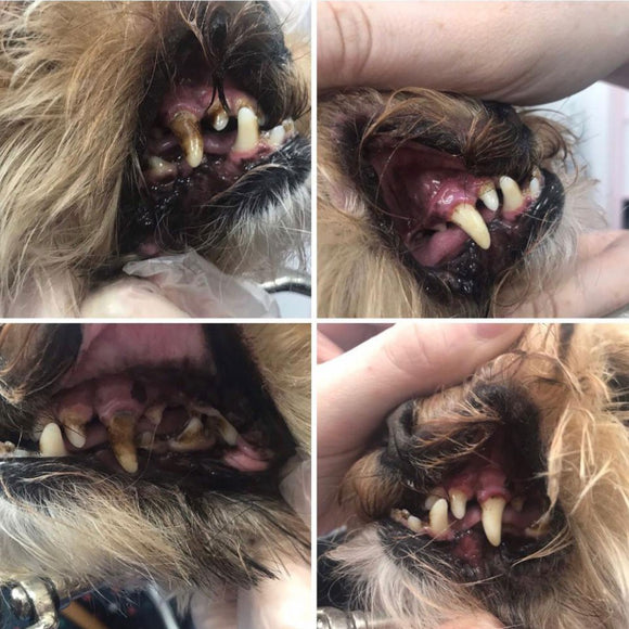 Cleany Teeth Ultrasonic Toothbrush Starter Pack 2.0 – Advanced Tartar Removal, 2024 Model